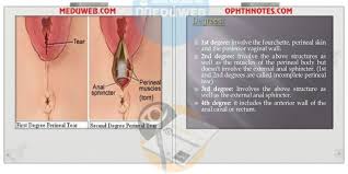 Pin On Gynecology And Obstetrics