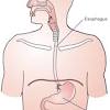 What kind of surgery is the mckeown procedure? Https Encrypted Tbn0 Gstatic Com Images Q Tbn And9gcqyqmpjbad1kmwppowfwir9gbtijk Bapg4 Wiiacvghmofzquo Usqp Cau