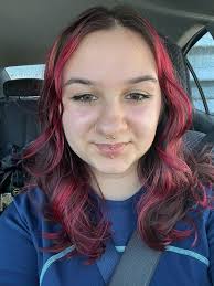 Can I put polysporin