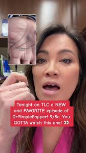 #duet with @tlc #drpimplepopper this episode is one of my FAVORITES of the  season! Tonight!