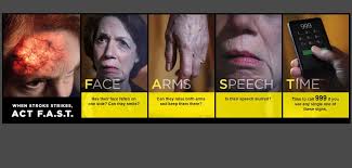 Most signs and symptoms disappear within an hour, though rarely symptoms may last up to 24 hours. Many Stroke Patients Experience Delays In Seeking And Receiving Care University Of Oxford