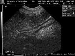 Spots On Your Liver When Discovered In An Ultrasound Examination And Or X Ray Are Almost Always Some Form Of Ultrasound Fatty Liver Disease Spot On