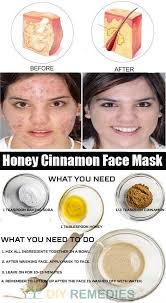 Naturkosmetik Diy Gesichtsmaske Honig Und Zimt Gesichtsmasken Selber Machen Honig Gesicht Und Gesichts Masken