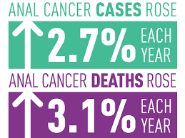 Anal Cancer Incidence and Deaths Rise in the United States - NCI