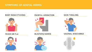 Image result for genital herpes