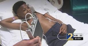 First Pediatric Diaphragm Pacemaker Implanted In Atlanta Georgia