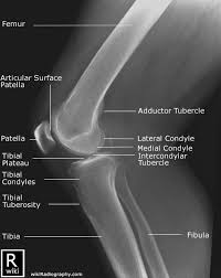 Radiographic Anatomy Of The Knee Lateral View Radiology Student Radiology Schools Medical Anatomy