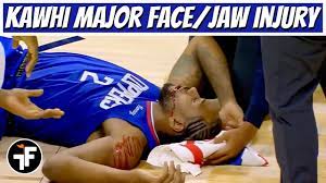 In his first game back after missing the previous five games due to right foot soreness, leonard had 16 points, six assists and five rebounds in 30 minutes in the. Kawhi Leonard Jaw Injury Elbowed In The Face By Serge Ibaka Youtube