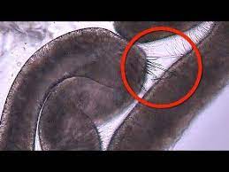 Microscopic High Speed Video Of Sea Anemone Tentacles Releasing Stinging Venom Jellyfish Sting Jellyfish Jellyfish Tentacles