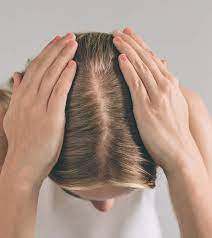 It was classified this way because it has a high risk of abuse and it can cause severe psychological and physical dependence. Does Adderall Cause Hair Loss Here S What You Need To Know