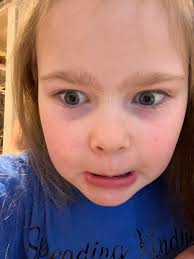 💙3/3💙 Colon Cancer Awareness Day