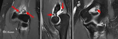 Richard ellenbogen, md, beverly hills, california. Die Ellenbogen Arthroskopie Arthro