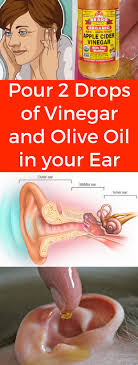 Pour 2 Drops Of Vinegar And Olive Oil In Your Ear Seeking Habit Ear Wax Olive Oil Ear Wax Removal