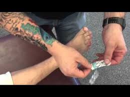 Image result for Hallux Varus