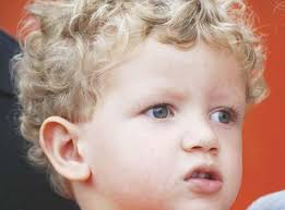 Baby Contest: Results