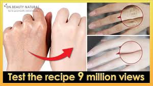 Keep in mind that accessorizing with bracelets or rings can give your fingers a slimmer appearance. Just 5 Mins Get Beautiful Fingers Hands How To Lose Fat Fingers Make Fingers Longer Thinner Youtube