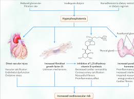 Image result for Hyperphosphatemia