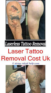 How Long Does One Session Of Tattoo Removal Take How To Remove Permanent Tattoo Diyper Tattooentfernung Tatowierungen Temporare Tatowierung