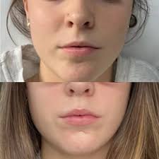 Tabatha Simon, RN at DermaGlo Medical Aesthetics in Canada, Ontario, Ottawa 