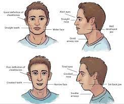 Jaw And Facial Development In Children Apex Dental Dentist Des Moines Iowa