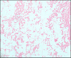 Image result for Rhizobium radiobacter, syn. Agrobacterium tumefaciens