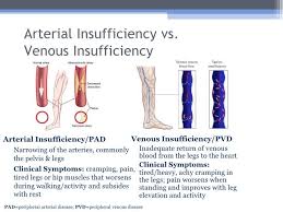 Difference Between Venous Insufficiency And Arterial