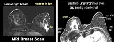 Ct scans can be used to identify disease or injury within various regions of the body. Deep Learning Based Breast Cancer Classification Through Medical Imaging Modalities State Of The Art And Research Challenges Springerlink