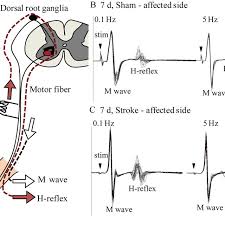 Er zählt zu den spinalen reflexen. The Rdd Of The H Reflex A An Illustration Of The H Reflex In The Download Scientific Diagram