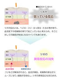 つわり 妊娠悪阻 鎌ヶ谷 船橋 松戸 鍼灸治療院ほっと ばらんす