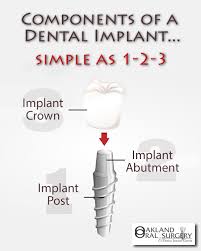 Pin On Oral Surgery