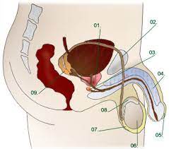 Testicular cancer is rare, but it's the most common form of cancer in males 15 to 34. Hed366 Midterm Diagram Quizlet