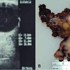 Image result for Submandibular Exam
