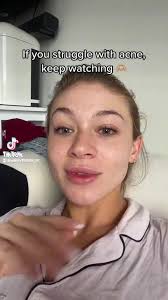 Talking about my AviClear experience! Such a game changer and I went to  Shafer Clinic in Midtown! #acne #acnetreatment #acneremoval #acneskincare  #acnetips #aviclear #clearskin