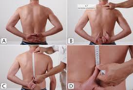 Image result for Shoulder Exam