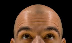 There is little written about men and much is left to be. The New Growth In Hair Loss Research Hair Loss The Guardian
