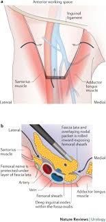 Skin changes in the vulva, including what looks like a rash or warts. Contemporary Management Of Patients With Penile Cancer And Lymph Node Metastasis Nature Reviews Urology