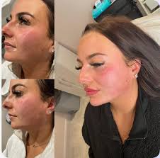 Alexandra Aesthetics Clinic