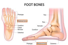 Image result for Metatarsal