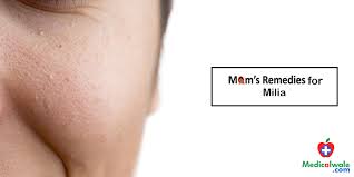 Check spelling or type a new query. Mom S Remedies For Milia Milia Treatment Medicalwale Com