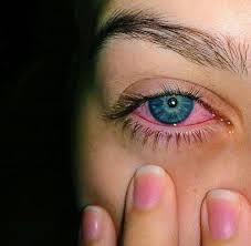 Pin On Eyes Windows Of The World