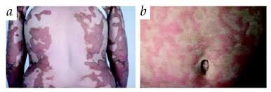 Image result for Erythrococca polyandra