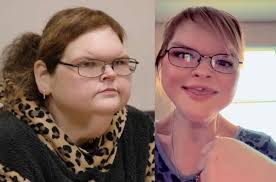 Tammy's face lift photos and reactions