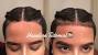 Baby Hairs On Hairline Men