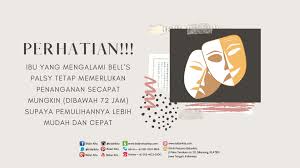 The exact cause is unknown. Bell S Palsy Dalam Kehamilan Bidan Kita