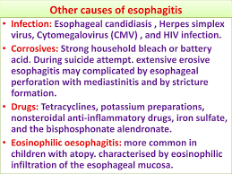 Commonly seen in aids patients. Diseases Of The Esophagus Tucom Dep Of Medicine 4th Year Dr Hasan I Ppt Download