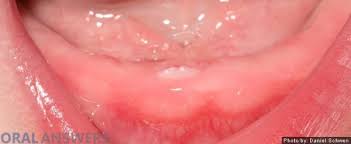 Pin On Baby Food Teething