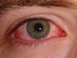Common symptoms include headache, loss of smell and taste, nasal congestion and rhinorrhea, cough. How Long Does Pink Eye Last 7 Signs You Are Still Contagious