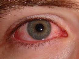 how long does pink eye last 7 signs