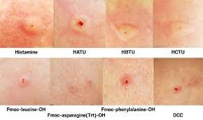 What Is An Allergy Sensitizer And How Does A Chemical Become One