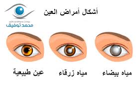 تكلفة عملية المياه البيضاء 2020